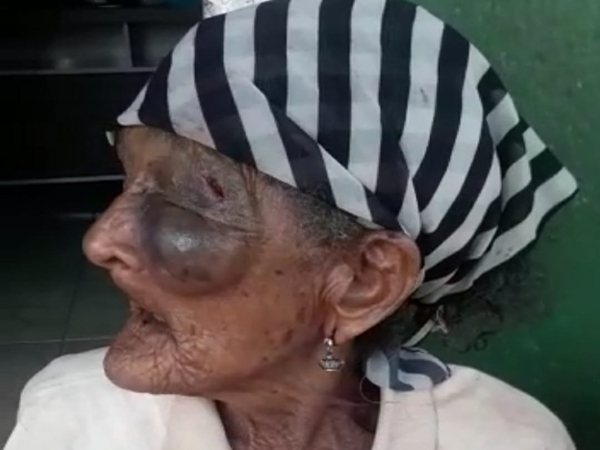Homem espanca idosa de mais de 100 anos em Iaçu