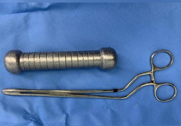 Peso de academia de 2kg é encontrado por médicos dentro de paciente em Manaus