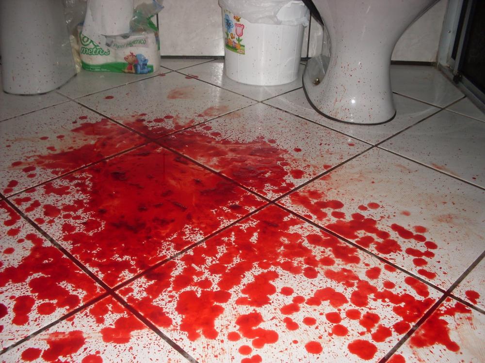 Com ciúmes, homem arranca olho da esposa com as próprias mãos