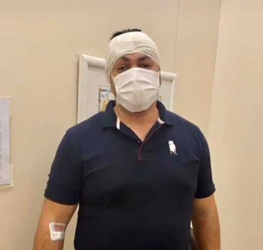 Prefeito de Crisópolis Leandro Dantas sofre acidente mas passa bem; Entenda