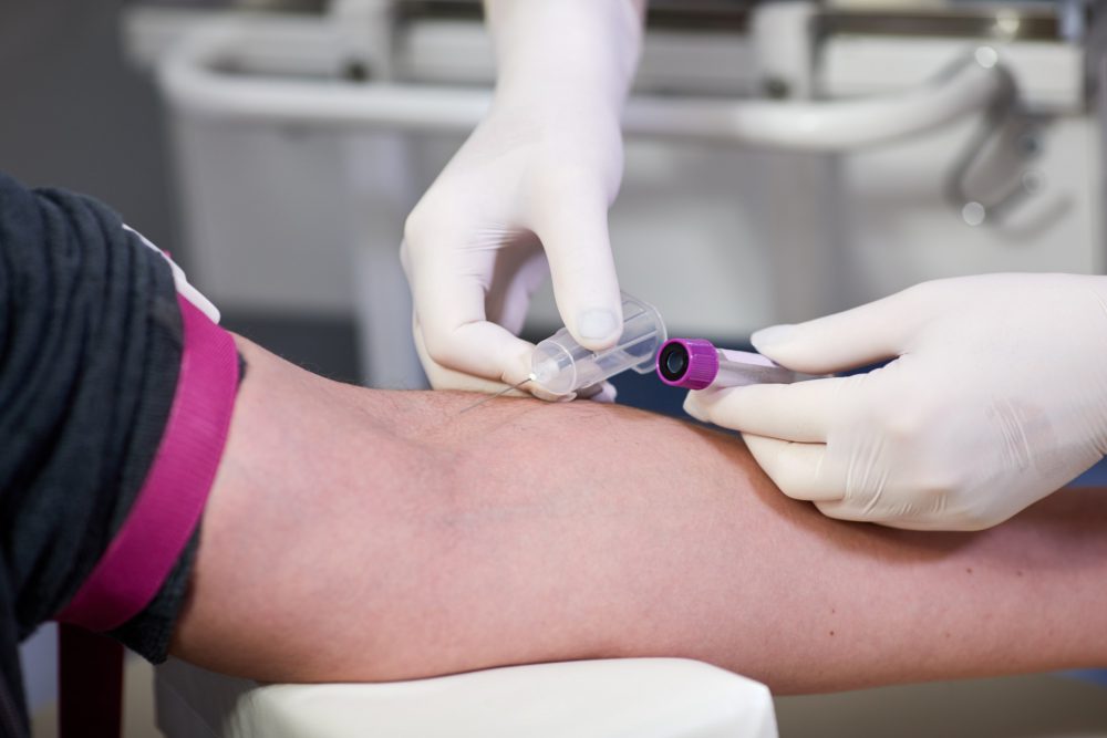 População jandairense é beneficiada com ampliação do acesso a exames laboratoriais gratuitos