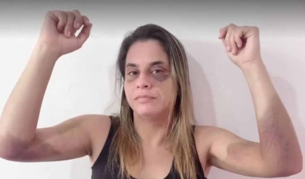 Caso de mulher que foi torturada pelo ex-companheiro com uma espada em Alagoinhas é exibido pela Subaé