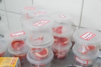 SESAU entrega novas próteses dentárias para usuários do SUS de Cardeal da Silva