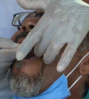 Governo Júnior Argôlo de Entre Rios entrega novas próteses dentárias para munícipes