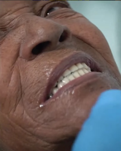Prefeito Júnior Argôlo acompanha entrega das próteses dentárias a população de Entre Rios